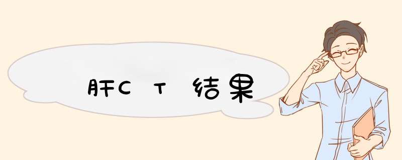 肝CT结果,第1张