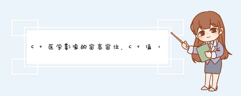 CT医学影像的窗高窗位、CT值（Hu值）,第1张