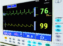 心电图仪设计综述,病人监护仪所显示的ECG和血氧读数,第2张