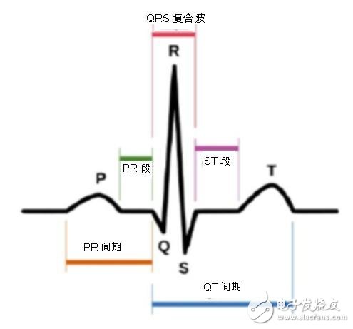 微电子机械系统加速传感器瞄准医疗领域的应用,图一：心电图中的 P-QRS-T波,第2张