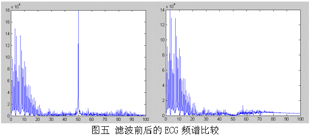 采用MSP430设计的12位心电(ECG)放大器,第8张