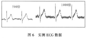 基于C8051单片机的无线心电监护系统设计,第7张