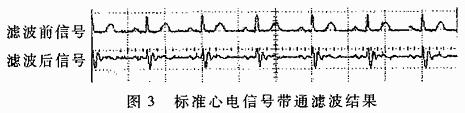 基于DSP的心电监护模块设计,第4张