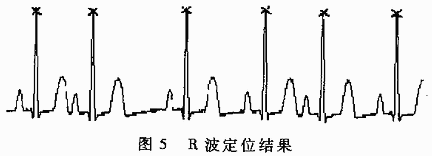 基于DSP的心电监护模块设计,第6张