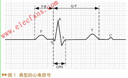 基于MATLABSIMULINK的心电信号源系统设计,第2张