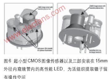 浅析低成本CMOS图像传感器对医学技术发展前景,第7张