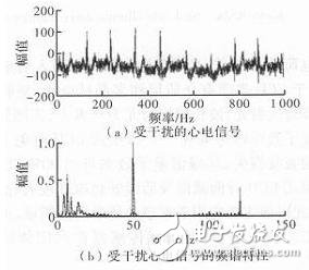 心电信号检测中滤除肌电干扰的方法解析,心电信号检测中滤除肌电干扰的方法解析,第5张