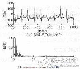 心电信号检测中滤除肌电干扰的方法解析,心电信号检测中滤除肌电干扰的方法解析,第6张