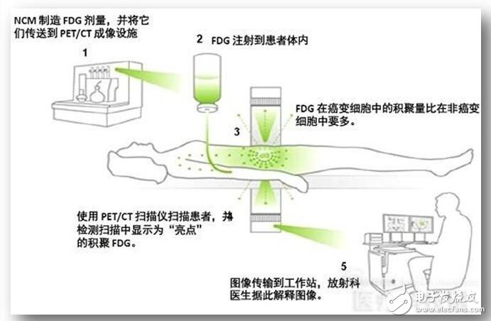 区分PET和PET-CT,PET和PET-CT的区别,第3张