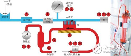 当今医疗设备设计师的终极挑战：节约空间，赢得竞争,血液透析机要求极其精确地测量患者血压和透析液（清除血流中的毒素）压力,第2张