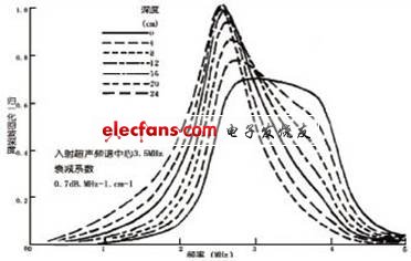 基于FPGA的超声诊断仪动态滤波器的设计,第2张