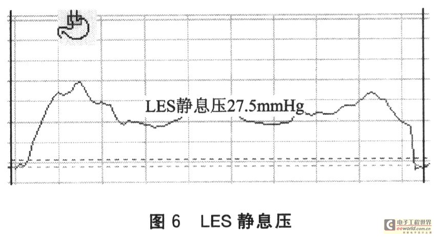 基于LabVIEW的食管动力检测系统设计,第7张