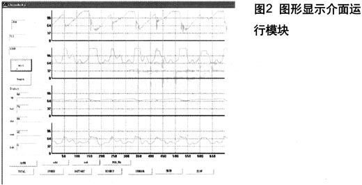 基于单片机、CCD传感器和无线收发模块实现智能车实时监测系统设计,第4张