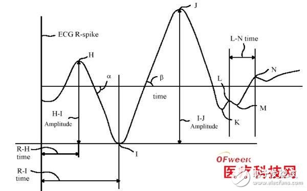 在心搏图测量中加速度传感器有什么作用？,在心搏图测量中加速度传感器有什么作用？,第3张