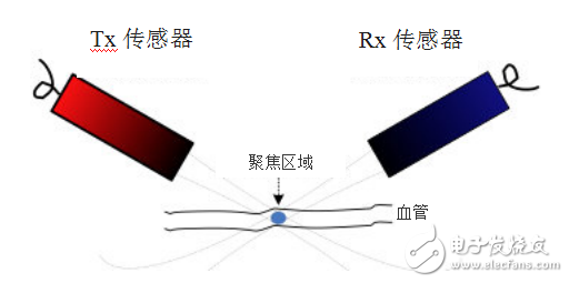 超声系统的信号链设计注意事项,超声系统的信号链设计注意事项,第16张