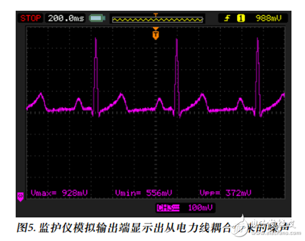 微功耗IC免除心率监护仪的后顾之忧,第8张