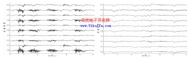 汽车驾驶时脑电干扰的去除方法研究,第2张