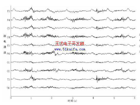 汽车驾驶时脑电干扰的去除方法研究,第3张