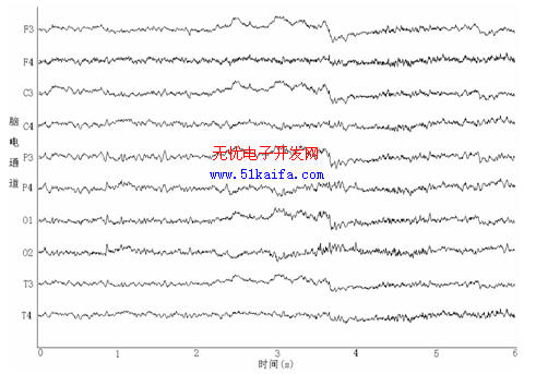 汽车驾驶时脑电干扰的去除方法研究,第4张