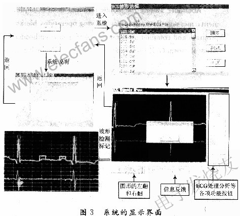 基于ARM9芯片AT91SAM9261S的心电诊断系统的设计,第5张