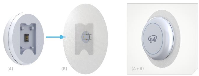 使用动态血糖监测设备(CGM)管理糖尿病,pYYBAGGMg_KAdKQ6AAE7ACE_s_E679.png,第4张