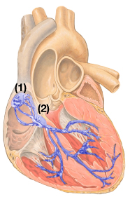 ADI医疗应用:检测并区分心脏起搏伪像,第2张