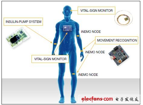 生物医疗传感器帮助盲人重见光明,图1,意法半导体公司开发了一些用于个人与诊断的传感器应用,第2张