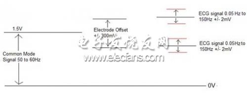 精确心电图(ECG)信号处理,第4张