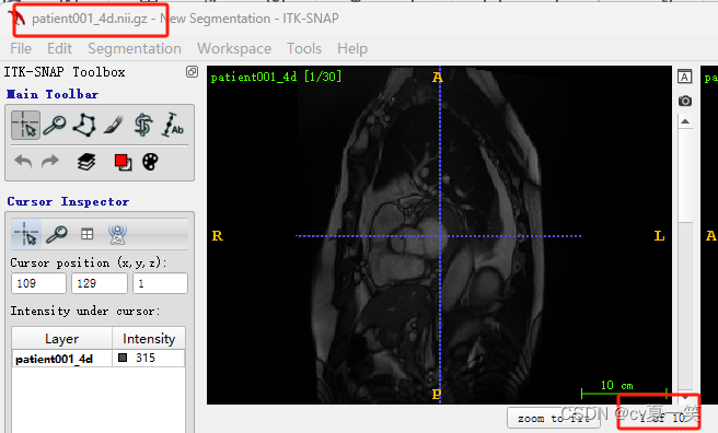 【ACDC数据集】：预处理ACDC心脏3D MRI影像数据集到VOC数据集格式，nii转为jpg，label转为png,在这里插入图片描述,第4张